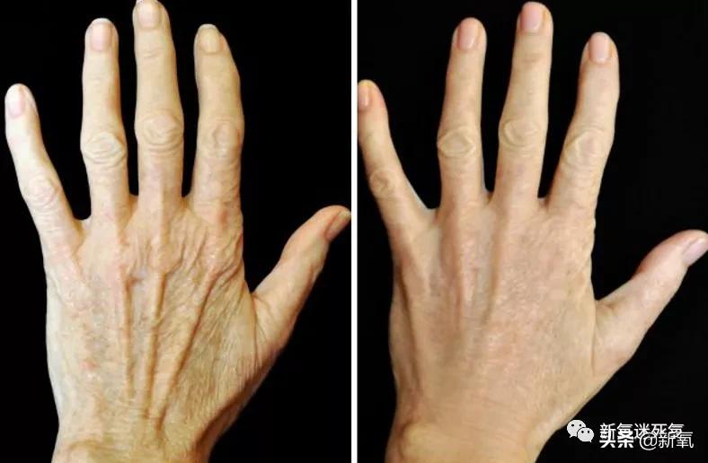 一个人变老的四种表现,一个人的年龄在脸上能不能看出来