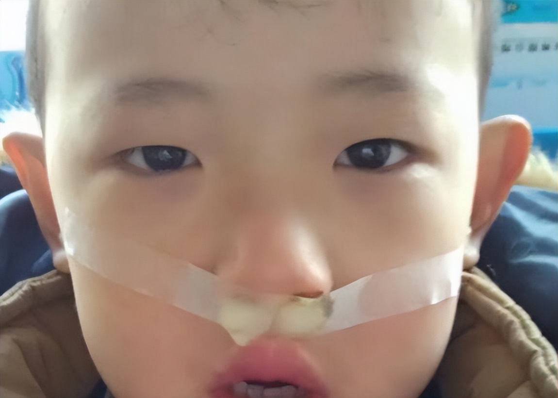 春夏正是治疗鼻炎的好季节，鼻炎患者千万莫要错过了，失不再来