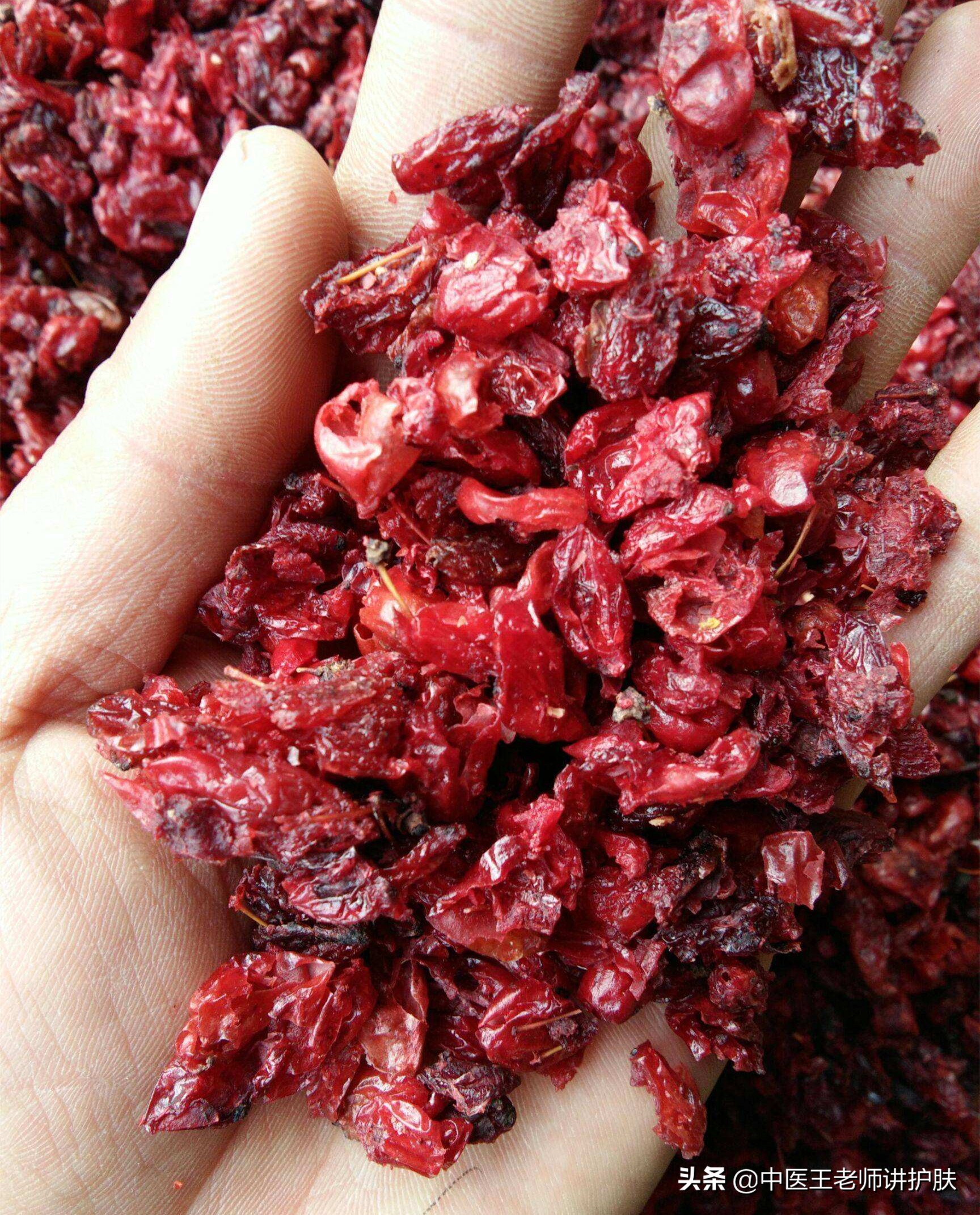 肝肾阴虚长斑怎么去掉,女人肝肾虚长斑怎么治