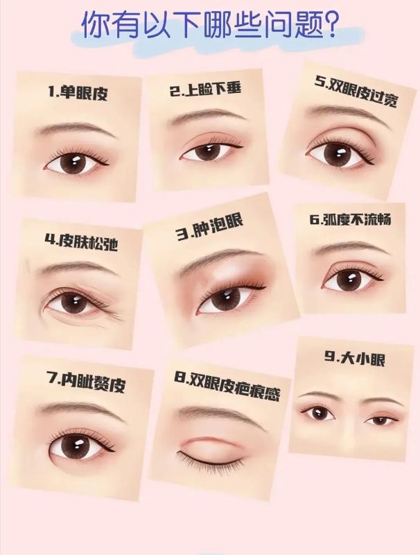 广州做双眼皮好的三甲医院和医生,西京医院双眼皮哪个医生做得好