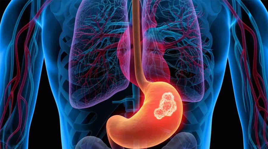 胃镜多久做一次合适正常人,做胃镜对胃有伤害吗需要注意什么