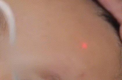 遮瑕色斑化妆的正确步骤教程,干性皮肤脸上有色斑怎么遮瑕