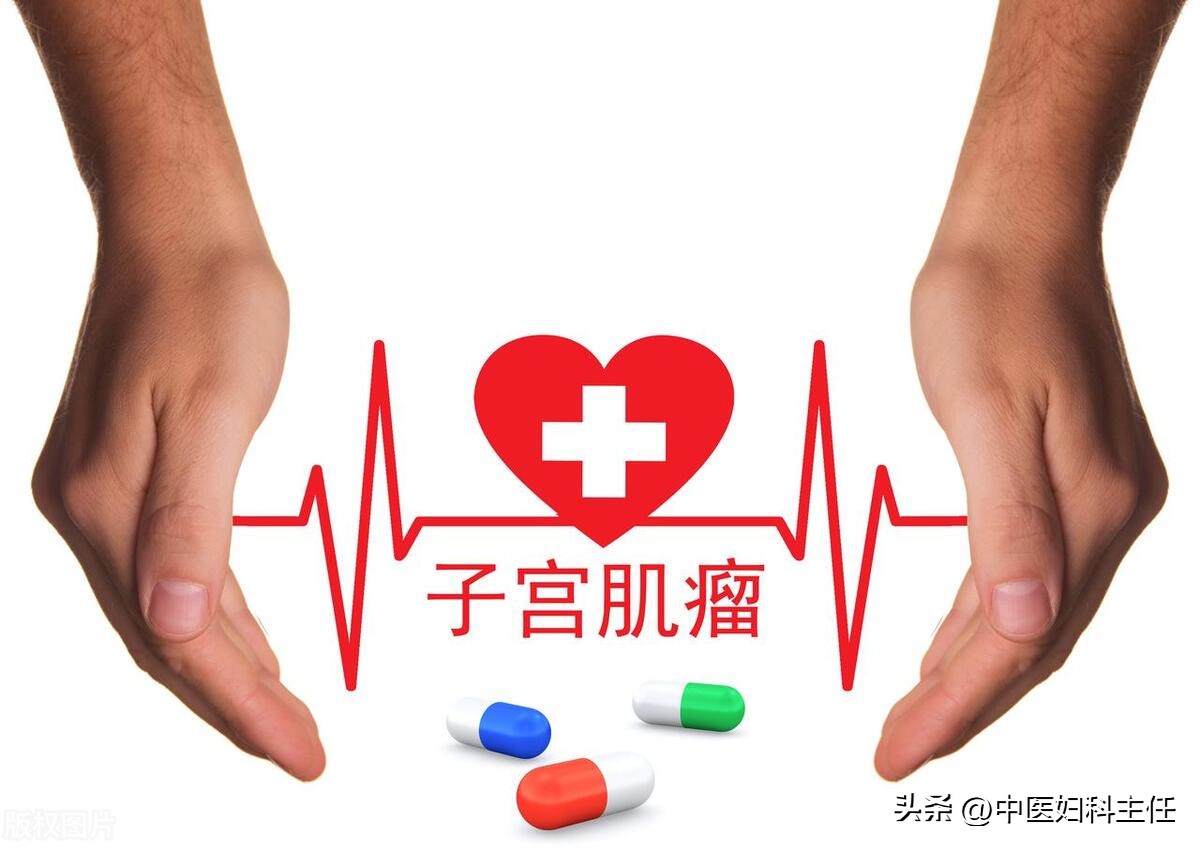 一个药方治好了三个子宫肌瘤,可以消子宫肌瘤的药物