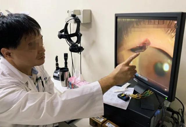 在农村喝井水会怎样,老家的泉水里面有蚂蟥