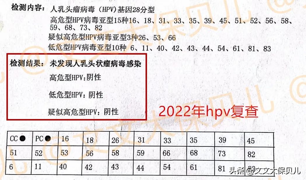 cin2-3累及腺体是宫颈癌吗,cin3级并累及腺体到宫颈癌多久
