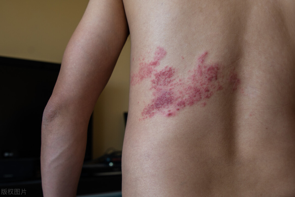 一分钟带你认识流感,一分钟让你认识光锥