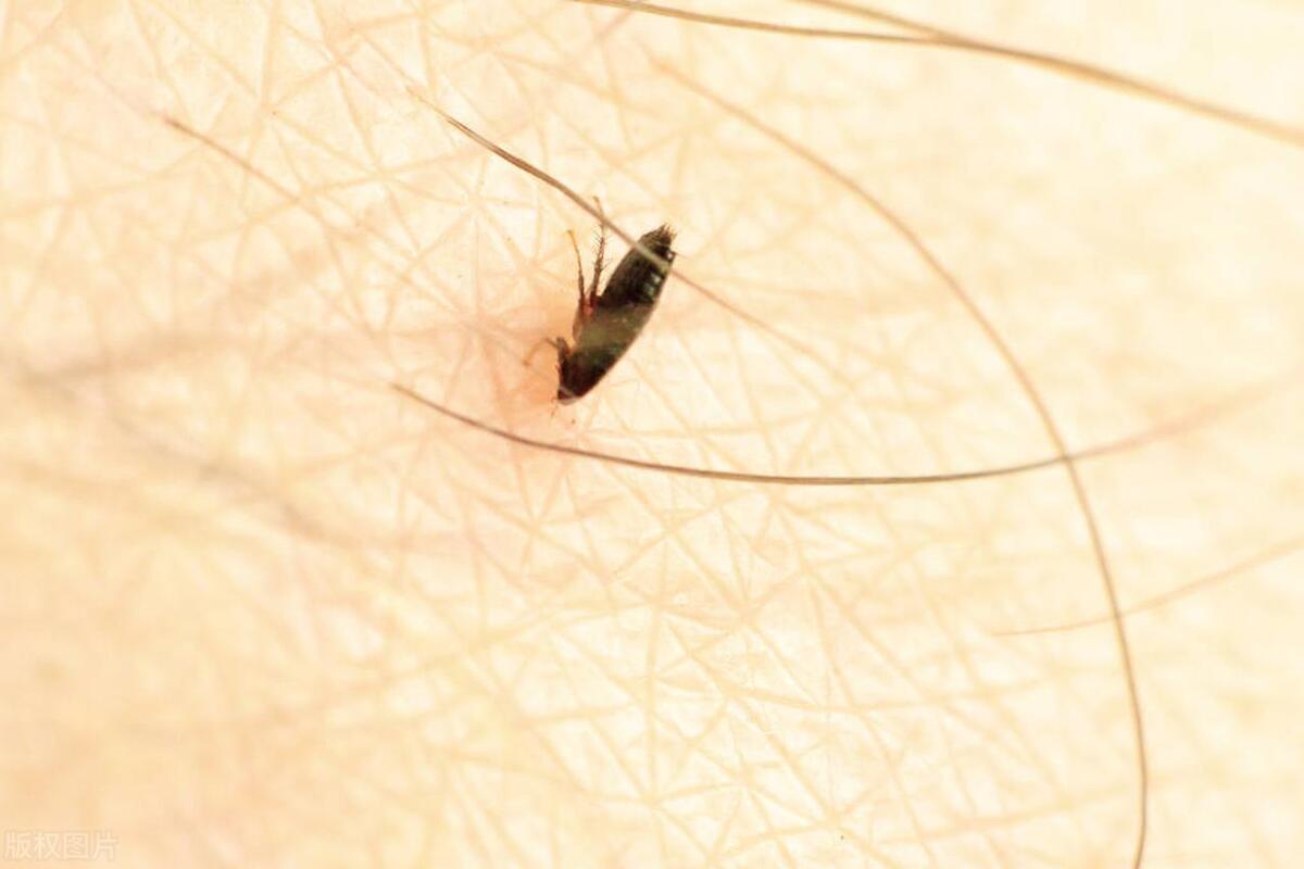 跳蚤怎么彻底消灭,跳蚤怎么消灭最彻底小妙招视频