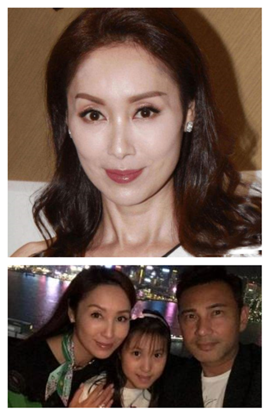 明星改善v型脸,为什么现在的女明星都是v型脸