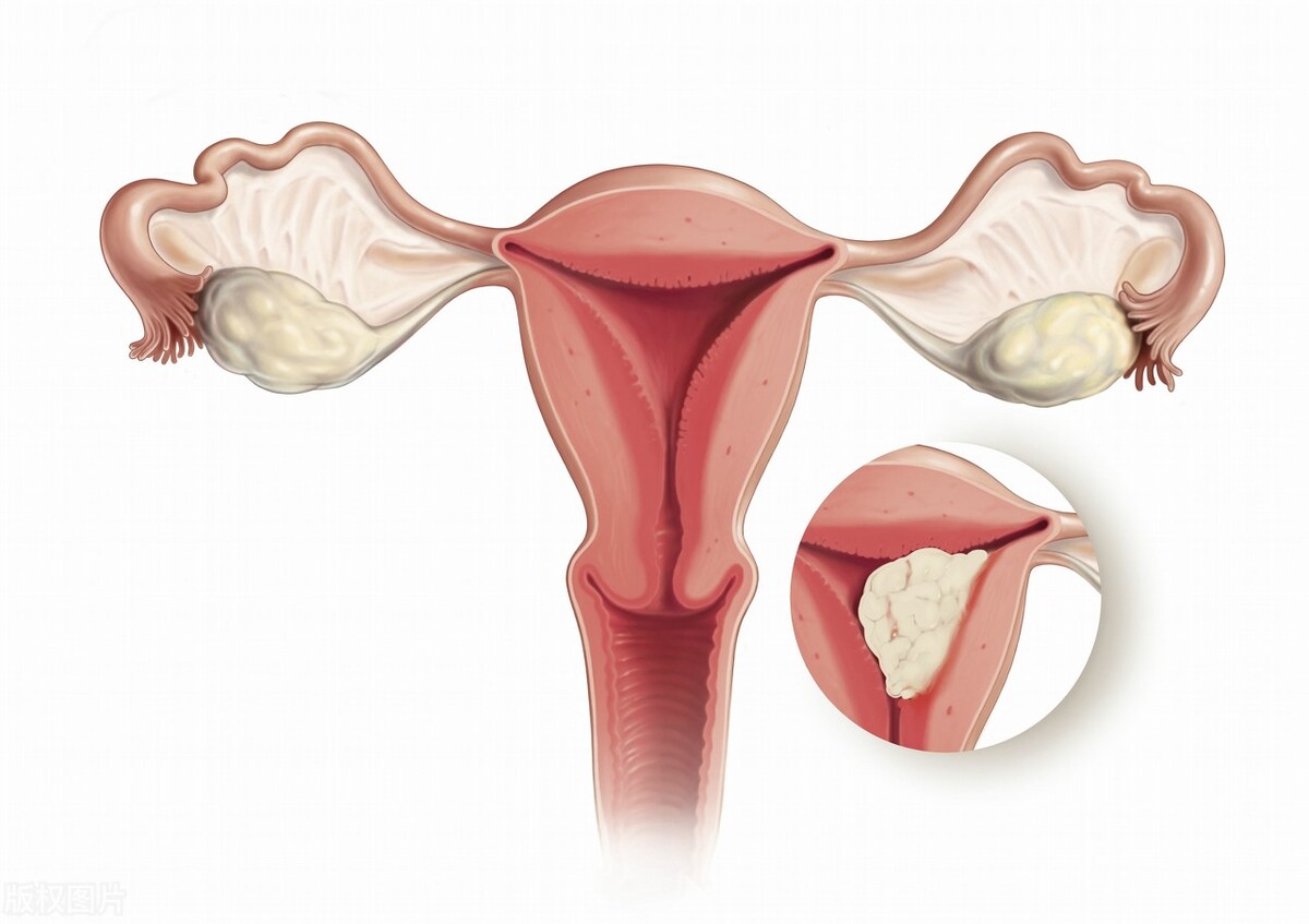 女人老了子宫能收缩吗,女性老了之后子宫会从哪里掉出来