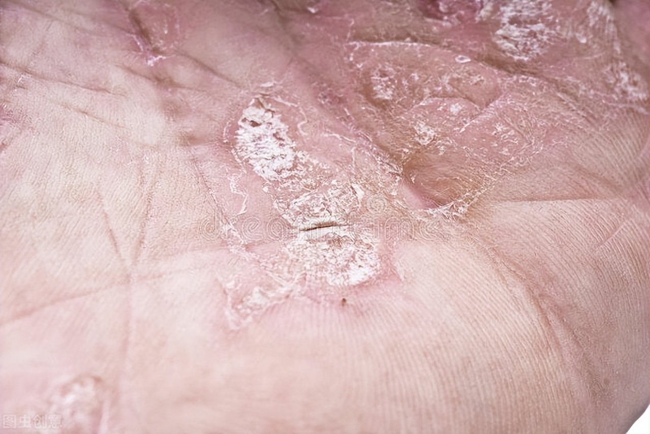 你的皮肤哪里出了问题,你的皮肤问题有哪些