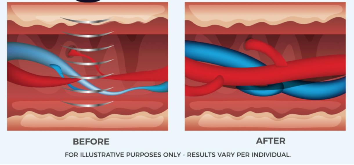勃起功能障碍---别忽略了是糖尿病惹的祸怎么办..