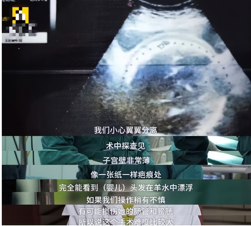 “美国春晚”超级女星怀二胎跳高台,网友:一年一个太强了!