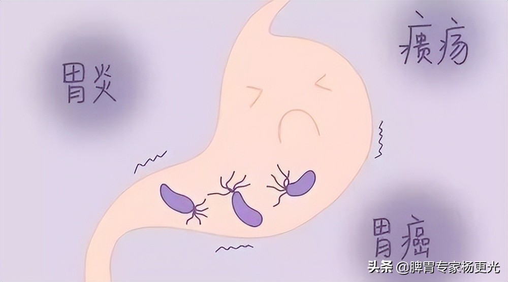 幽门螺杆菌要怎么检测才准确,幽门螺杆菌检测有什么注意事项