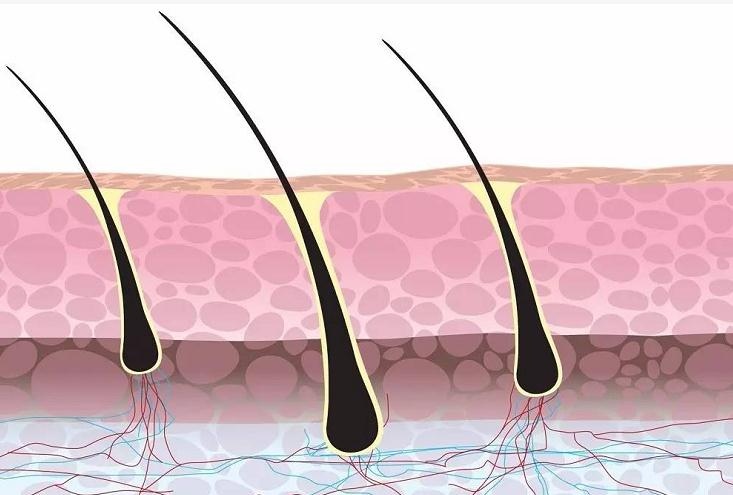 为何有人头发天生自然卷？看看不想让它卷的办法