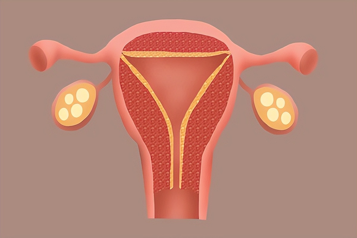 大姨妈一直不走怎么回事怎么治,大姨妈一直不走是什么原因造成的