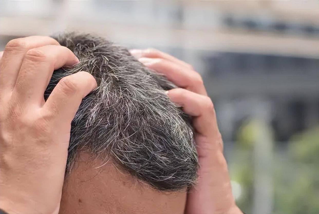 白发长在前面两侧后脑勺代表什么,白发长在正头顶代表身体哪个器官