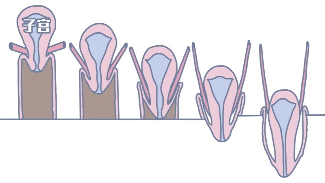 女性六十岁子宫脱垂怎么治疗,子宫脱垂一级的女性多吗