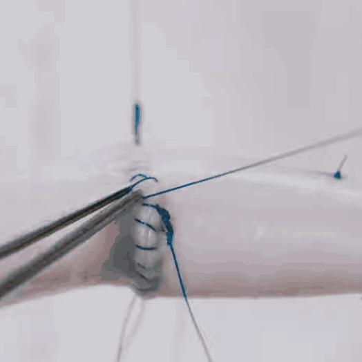 全球首例猪心移植人体内手术成功,美国医生首次将猪心移植入人体内