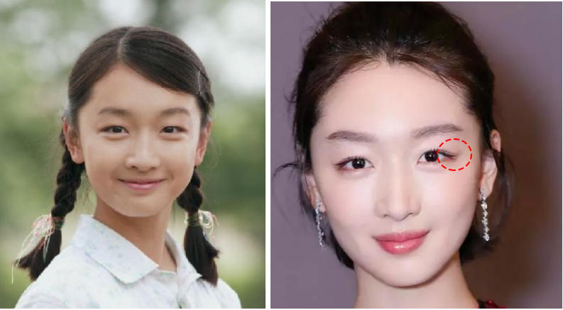 高级脸为什么看着显老,什么样的脸减龄