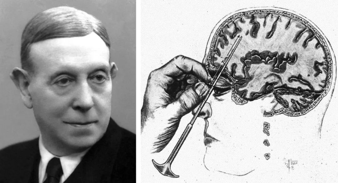 诺奖背后你不知道的10个癌症常识,诺奖黑幕