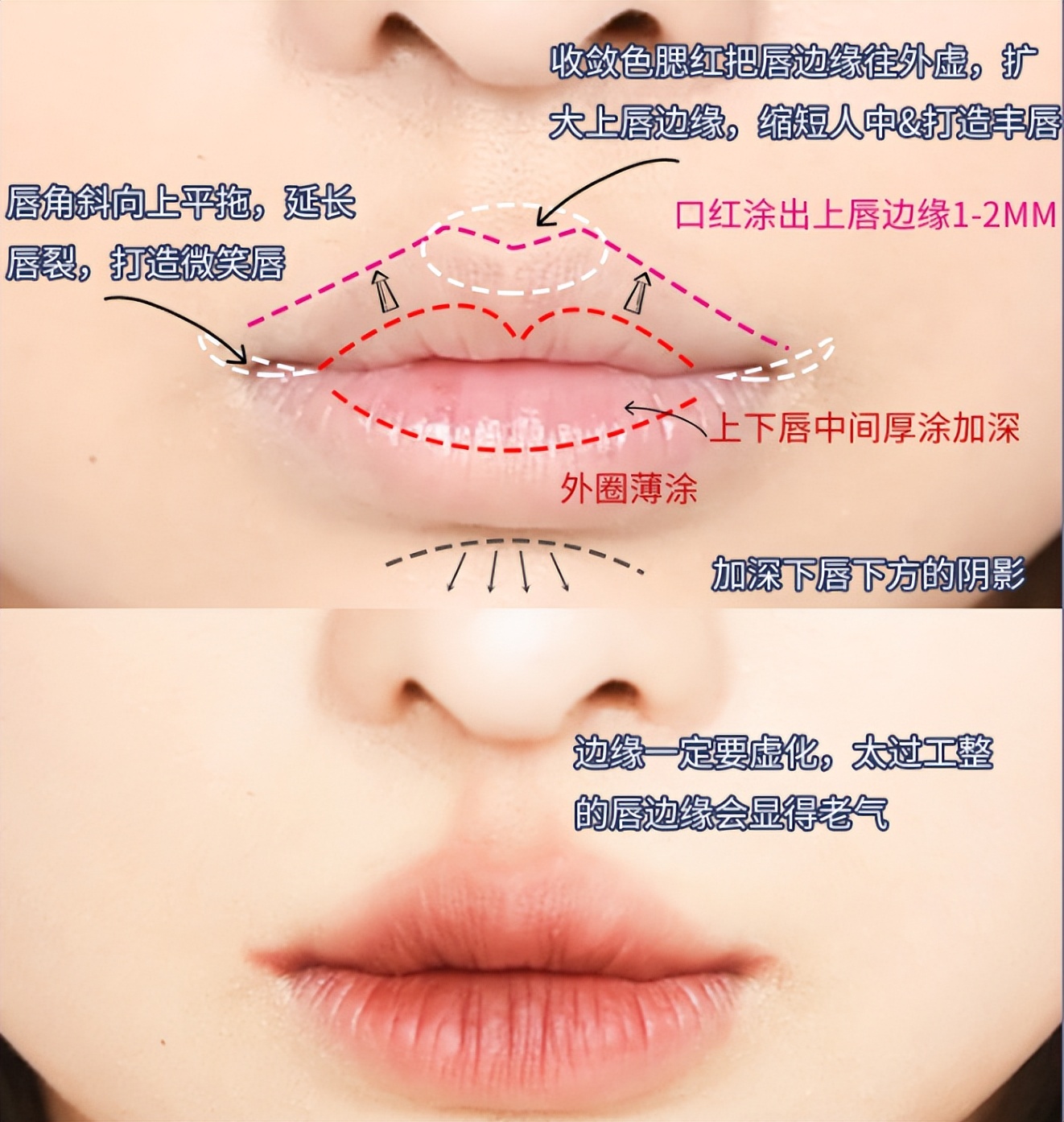 人中缩短修复,人中长显老怎么改善