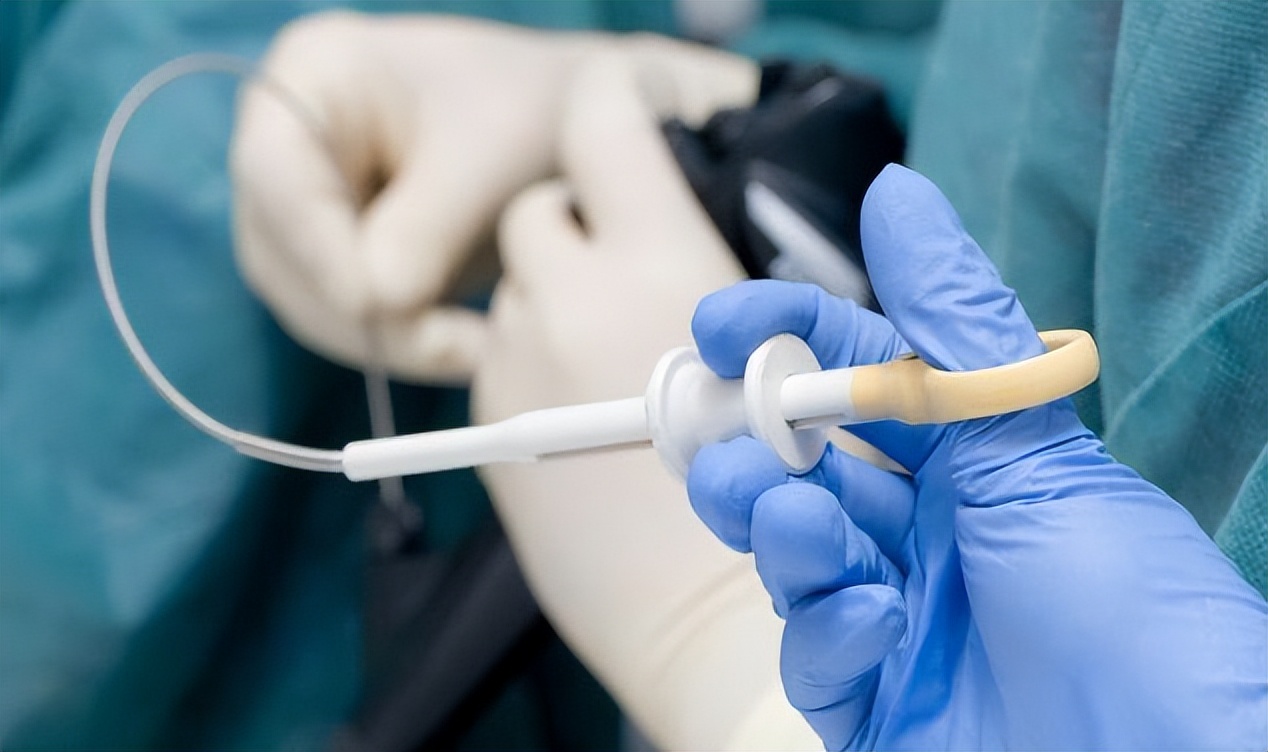 做完胃镜怎么看报告,做完胃镜怎么看胃有没有问题