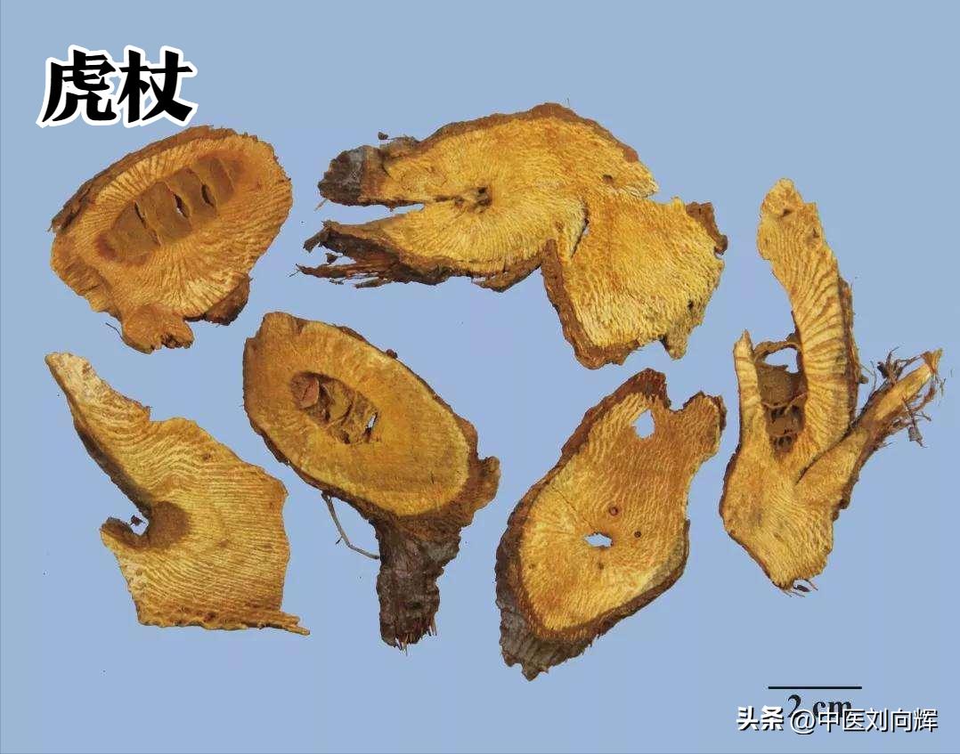 脂肪肝对应中成药,脂肪肝健脾除湿的中成药