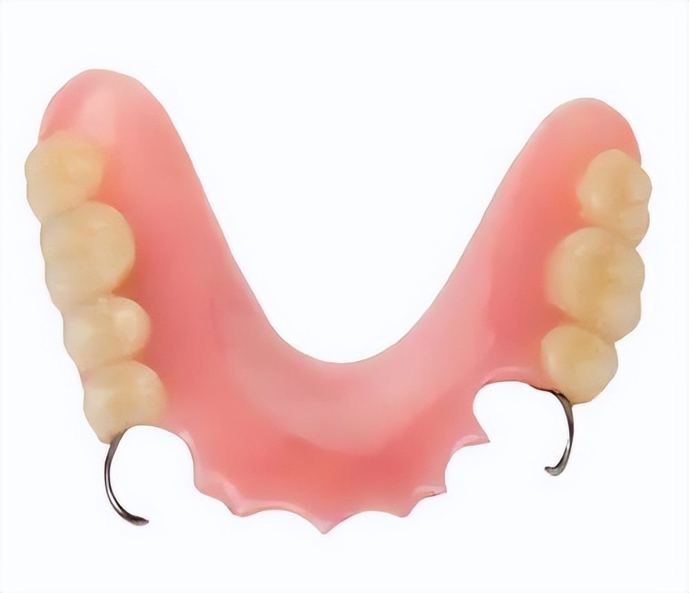 什么样的可乐牙需要治疗,健康科普温馨提示信息