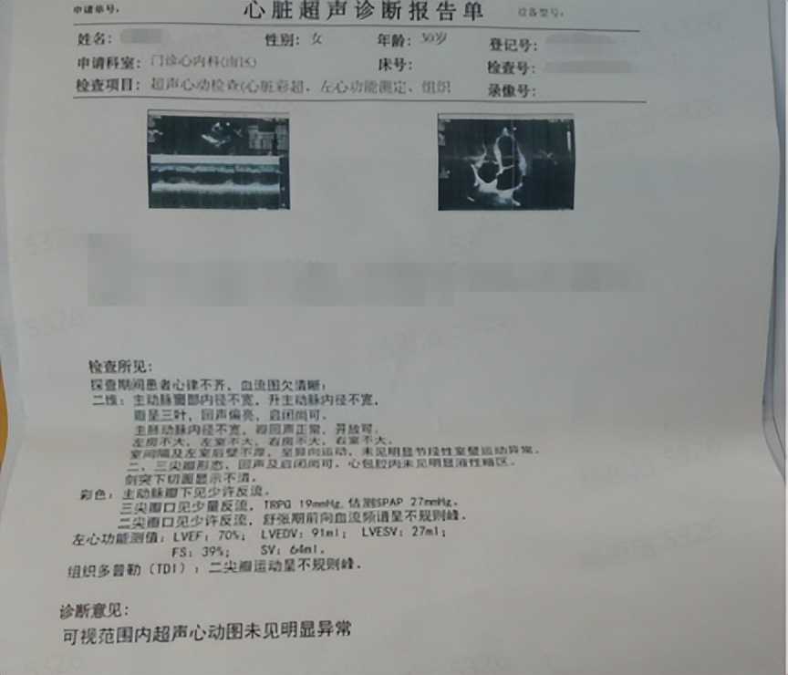 心慌心律失常吃什么药效果快,33多岁偶尔心慌吃什么药好