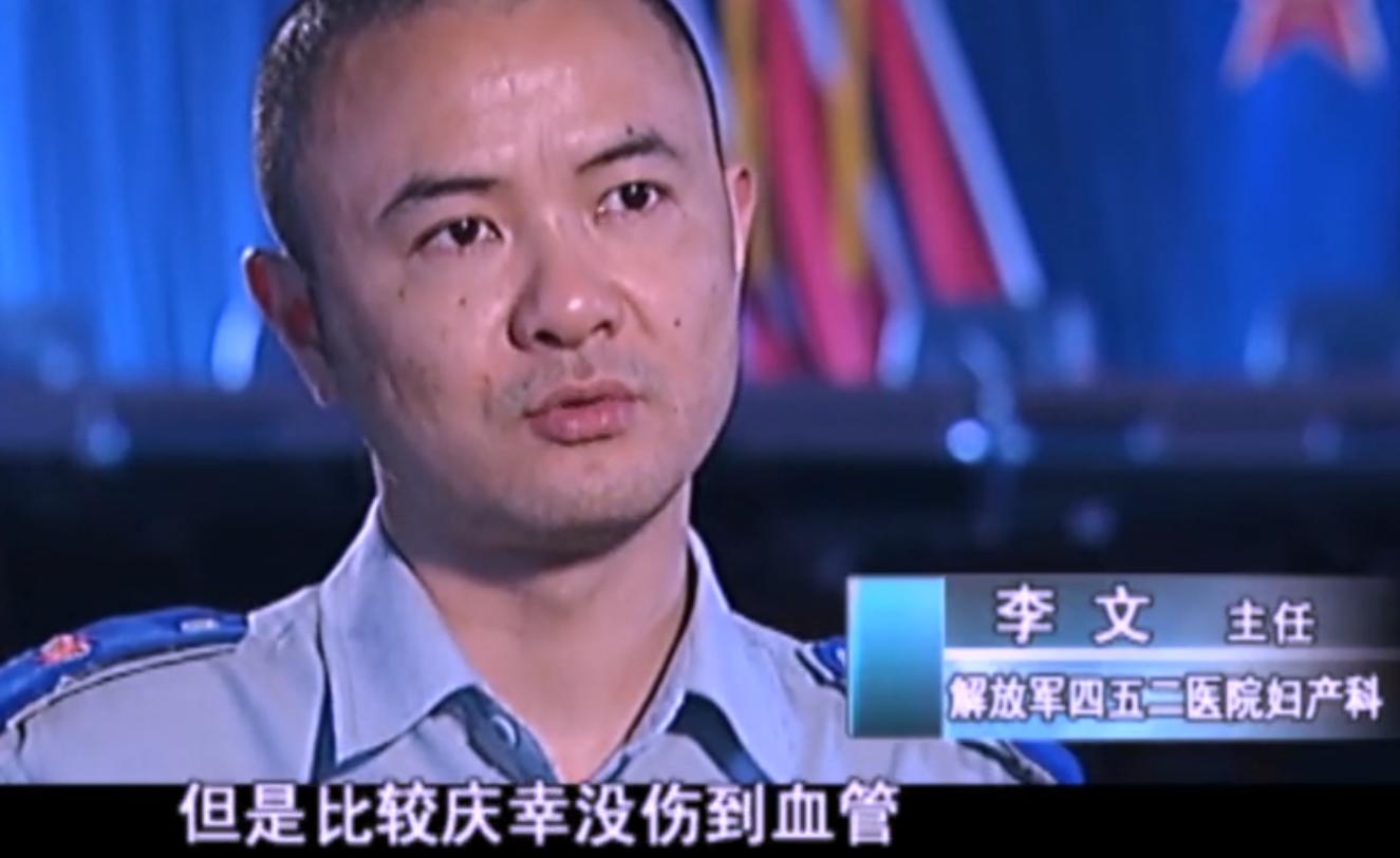 2007年四川90岁老妇，腹中怀子60年未生，后检查发现胎儿没有腐烂