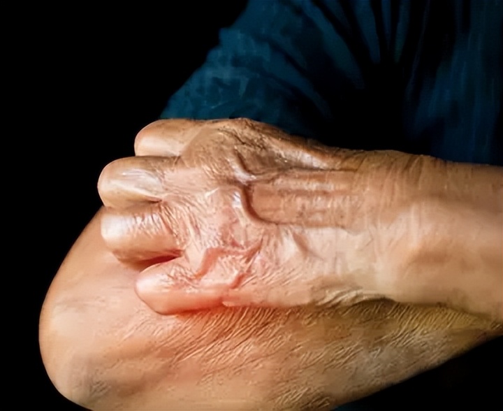 老年人经常过敏是什么原因,老年人经常过敏是怎么回事