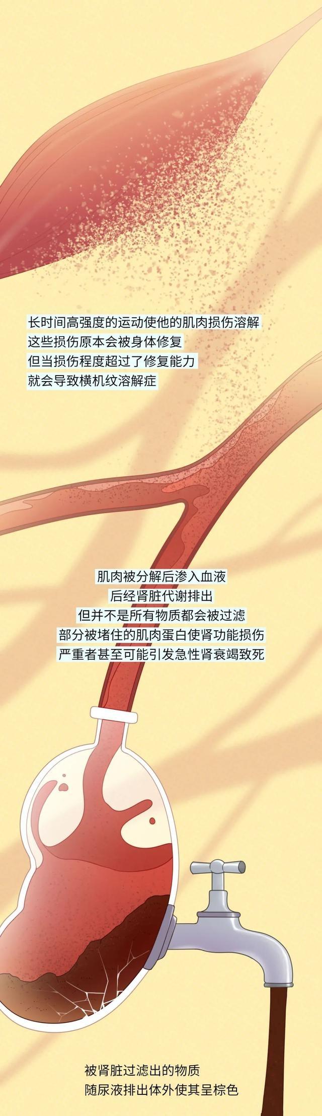 为什么跳跳绳会有大便的感觉,为什么跳完毽子操腿软