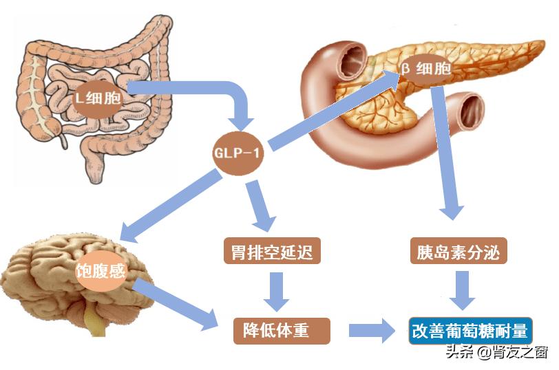 2类糖尿病跟胰腺有关吗,糖尿病病人的肠促胰素