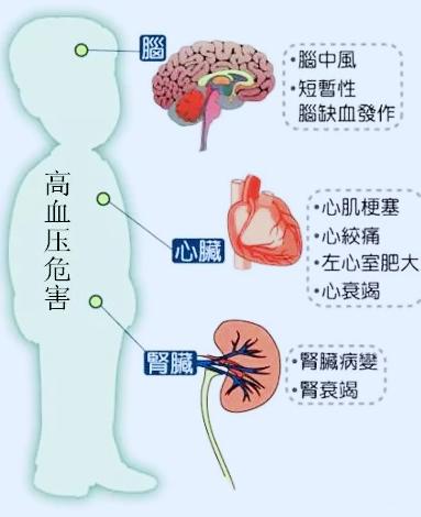 高血压先别着急吃药试试这个方子,高血压不要怕教你一招