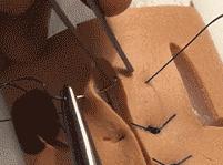 外科各种缝合方法的适用情况,外科操作缝合