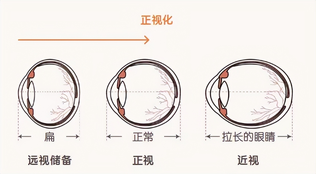 唱歌和钢琴哪个更伤眼睛呢,孩子学钢琴危害