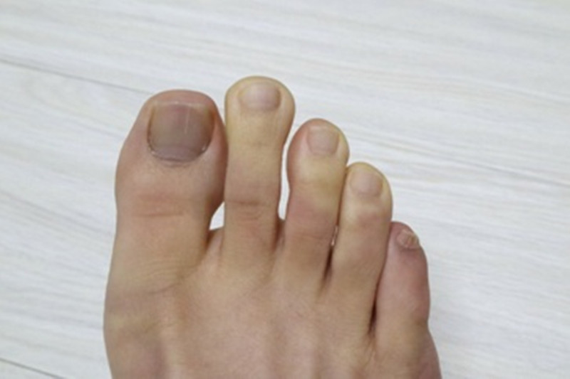 男士脚底出汗冰冷怎么治疗,脚底出汗感觉凉什么原因