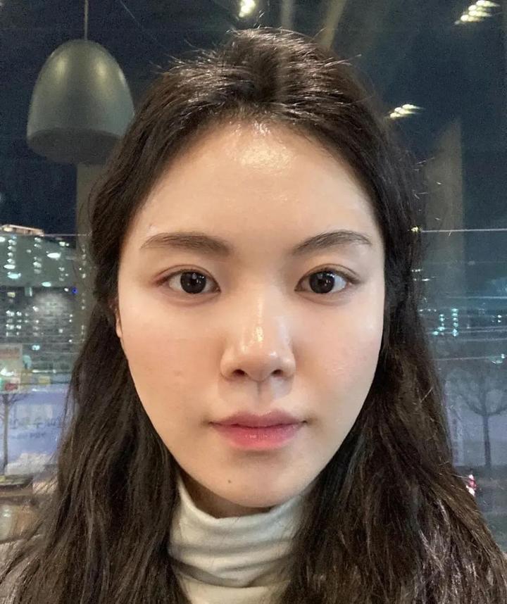 八大处医院杨喆抖音,八大处整形医院杨喆