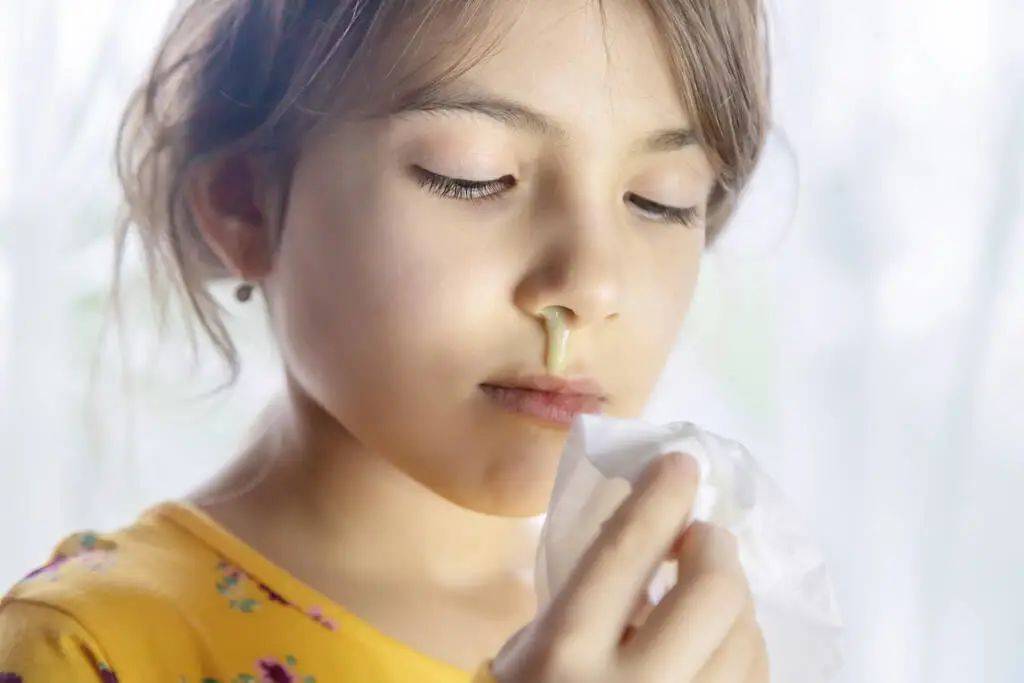 感冒黄绿色鼻涕是什么原因,感冒黄绿色浓稠鼻涕吃什么药