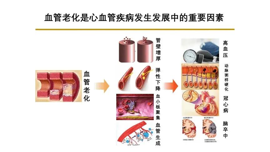 血管硬化该如何调理？可能是气虚，一张方子补气软血管