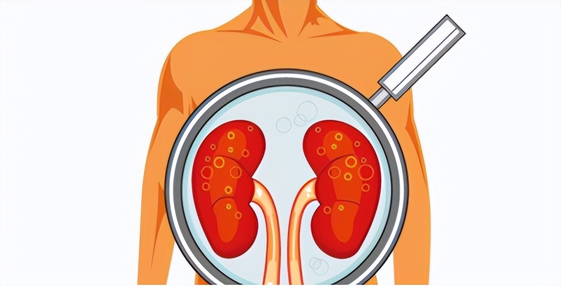 肌酐高就是代谢功能差吗,肾功能肌酐正常尿常规肌酐高