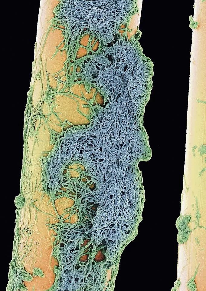 显微镜观察人体的四种组织图片,人体显微镜下的样子