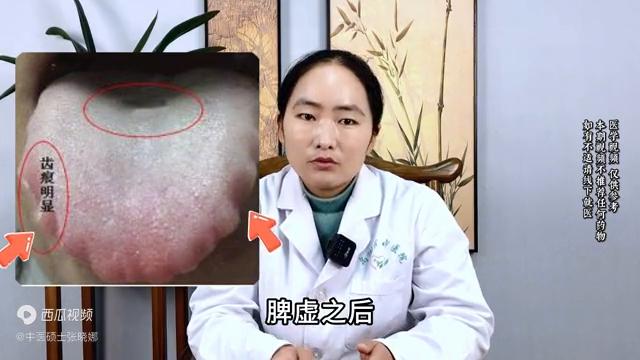 脾虚，吃归脾丸越补越虚？中医：病根全在舌头上，先化痰再健脾