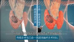 结节消融后就完全康复了吗,结节消除中成药