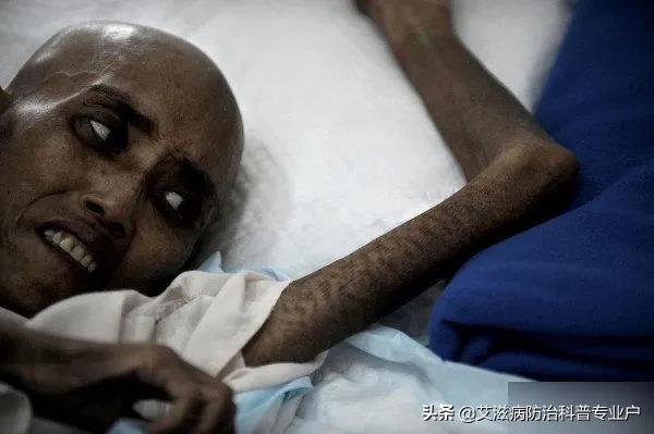 艾滋病抗病毒治疗cd4多久恢复正常,艾滋病抗感染要多少钱