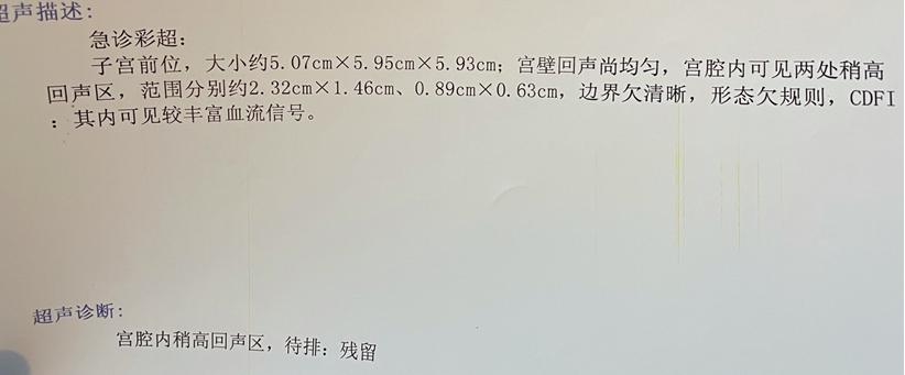 产后13天流好多血块,产后30天还流鲜血正常不