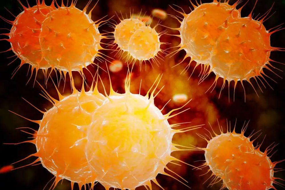 四物消风饮治疗慢性荨麻疹,四物消风饮治疗荨麻疹