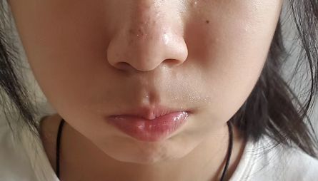 孩子嘴巴张不开发音小,小孩声带发育异常导致说话不清楚