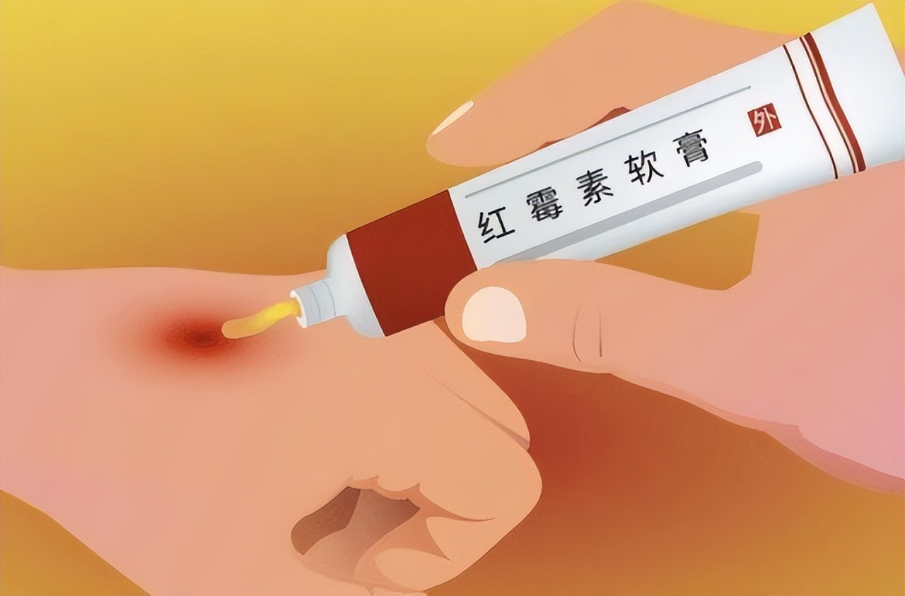 药店里的药便宜又好用店员不推荐,药店里四种药便宜又好用