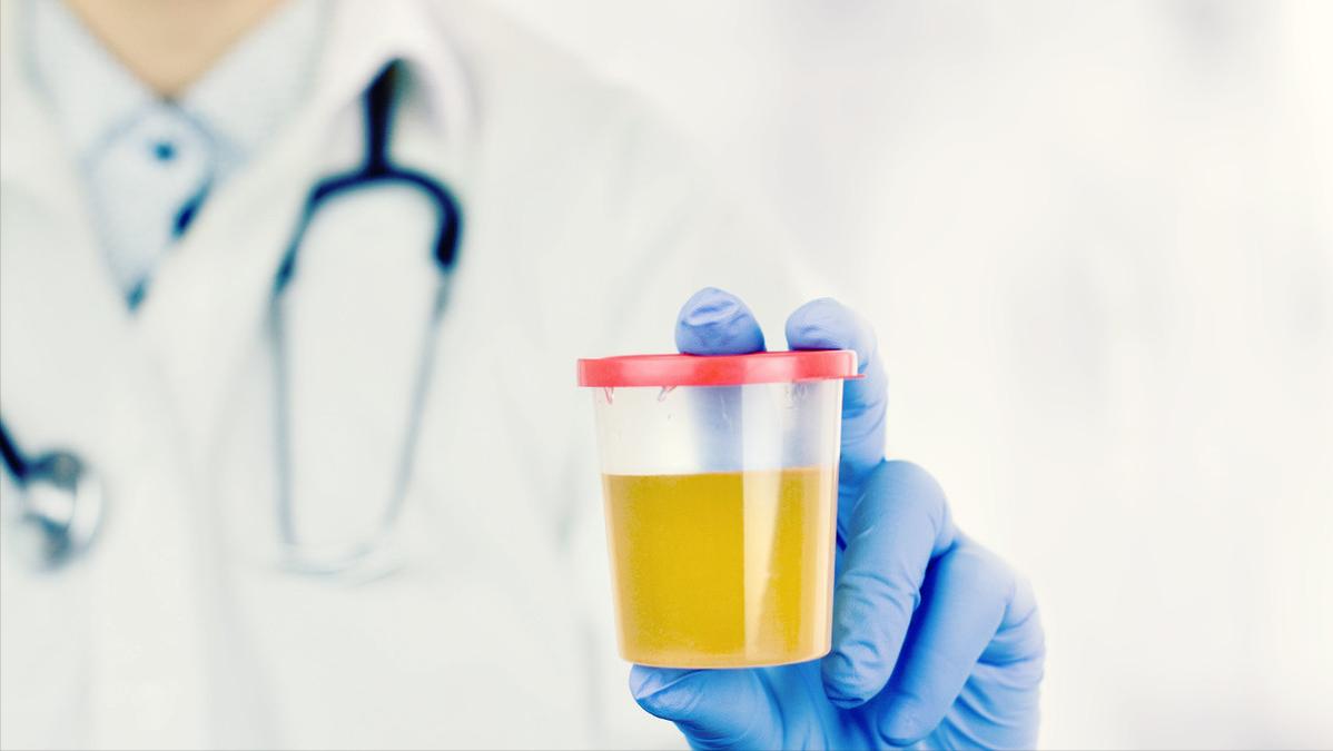 尿痛尿急尿路感染最快解决方法女,女性尿路感染但是不尿痛